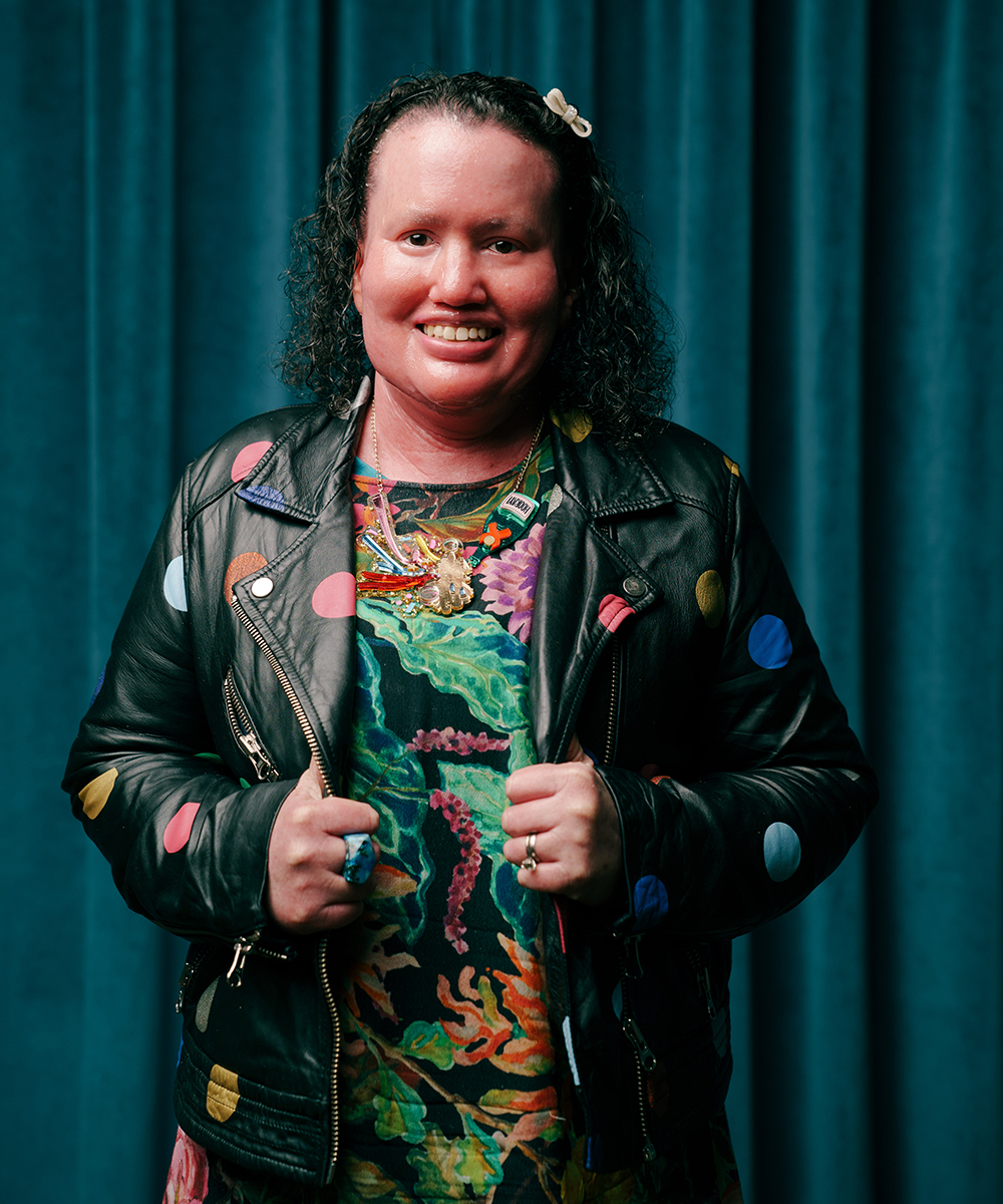 Writer Carly Findlay smiles at the camera, standing in front of a green wall. She's wearing a colourful dress and leather jacket. Her hands are holding the edge of the jacket.